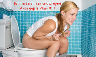 Illustration for article titled Penyakit Wasir Apa Berbahaya